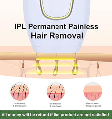 Home Use IPL Beauty Device – Painless Permanent Hair Removal System for Whole Body